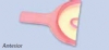 Neo Trays - Anterior 30/Bx