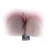 FenderPrep - A Wedge With A Large Vertical Steel Plate