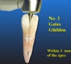 Essential Gates Gliden Drill Refills - Pack of 5
