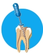 Endodontic Products